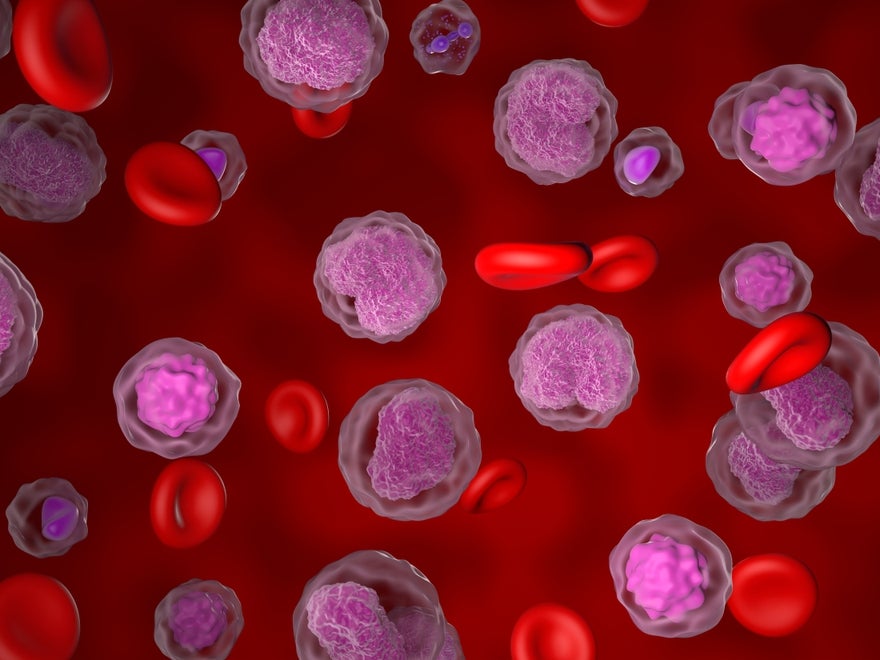 3D illustration of lymphoma  3D illustration of lymphoma