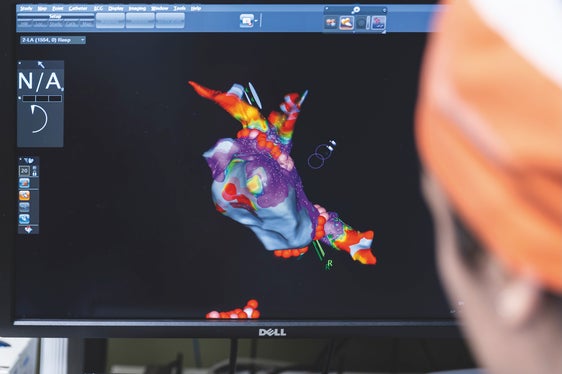 Il cuore del paziente da trattare viene riprodotto fedelmente sul computer della sala operatoria. I cuori delle donne sono talvolta più piccoli, ma non presentano quasi alcuna differenza visiva, mentre i sintomi, ad esempio in caso di infarto, sono diversi, afferma il team di Cardiologia. (Foto: Tiberio Sorvillo)