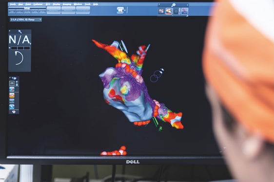 Am OP-Computer wird das Herz des zu behandelnden Patienten detailgetreu nachgebildet. Frauenherzen seien manchmal kleiner, würden sich aber optisch kaum unterschieden, wohl aber die Symptome bei beispielsweise einem Herzinfarkt, sagt das Team der Kardiologie im Krankenhaus Bozen. (Foto: Tiberio Sorvillo)