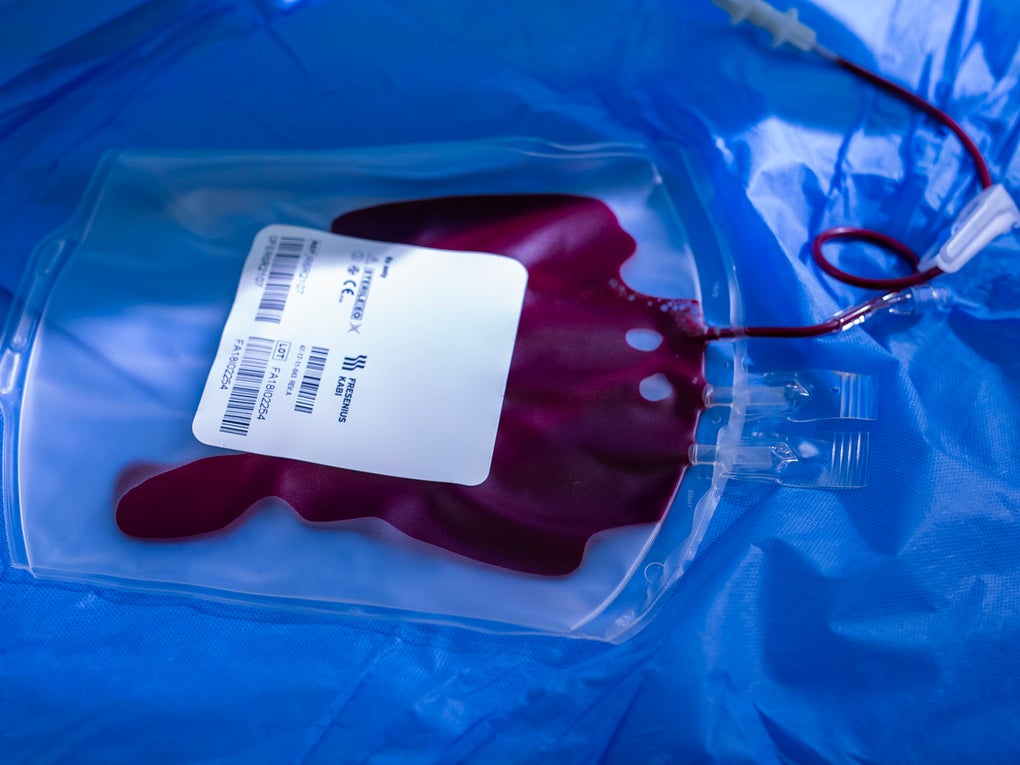 worek z życiem, komórki macierzyste worek z życiem, komórki macierzyste