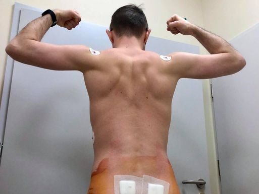 Łukasz Lewandowski - Dawca szpiku Łukasz Lewandowski - Dawca szpiku