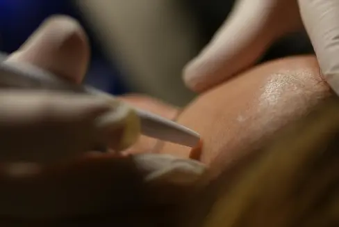 Künftig stehen in Südtirol deutlich mehr Plätze für angehende Dermatologinnen und Dermatologen zur Verfügung. Dies hat die Landesregierung beschlossen. (Foto: Pexels. Das Foto darf nur in Zusammenhang mit dieser Pressemitteilung verwendet werden.)