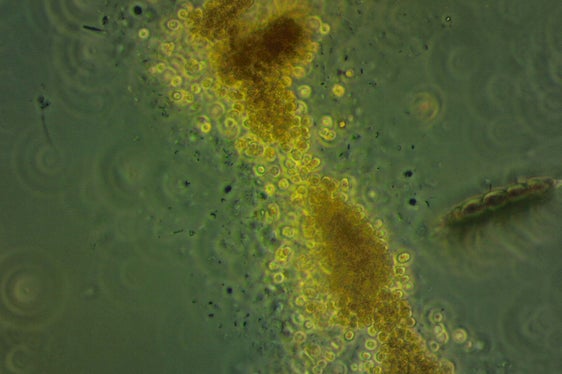I cianobatteri al microscopio: questi organismi possono produrre tossine pericolose per l'uomo e gli animali e possono causare irritazioni cutanee o problemi gastrointestinali. (Foto: ASP/Laboratorio Biologico)
