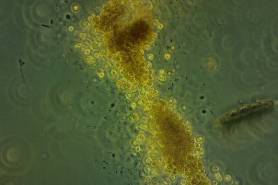 I cianobatteri al microscopio: questi organismi possono produrre tossine pericolose per l'uomo e gli animali e possono causare irritazioni cutanee o problemi gastrointestinali. (Foto: ASP/Laboratorio Biologico)