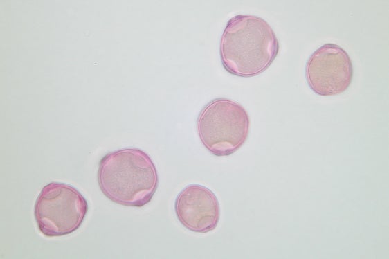 Da quasi trent’anni il Laboratorio biologico dell’Agenzia provinciale per l’ambiente e la tutela del clima assicura una diffusione tempestiva delle informazioni sui pollini tramite il Servizio d’informazione pollinica (Foto: Agenzia ambiente e tutela clima/Widmann)