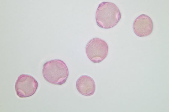 Da quasi trent’anni il Laboratorio biologico dell’Agenzia provinciale per l’ambiente e la tutela del clima assicura una diffusione tempestiva delle informazioni sui pollini tramite il Servizio d’informazione pollinica (Foto: Agenzia ambiente e tutela clima/Widmann)