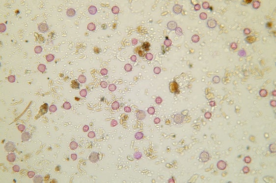 Eine Luftprobe des Frühjahrs unter dem Mikroskop mit den winzigen, rosa gefärbten Pollenkörnern: An gewissen Tagen zählen und bestimmen die Mitarbeiterinnen in einer Probe über 5.000 Pollenkörner. (Foto: Landesagentur für Umwelt und Klimaschutz)