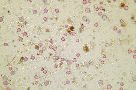 Un campione con minuscoli granuli di polline di colore rosa: in alcuni giorni vengono contati in un singolo campione oltre 5.000 granuli di polline. (Foto: Agenzia provinciale per l'ambiente e la tutela del clima)