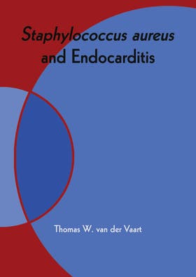 Cover proefschrift Thomas van der Vaart