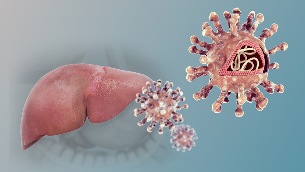 Hepatitis C virus and the liver. Credit: scientificanimations.com (CC-BY-SA)